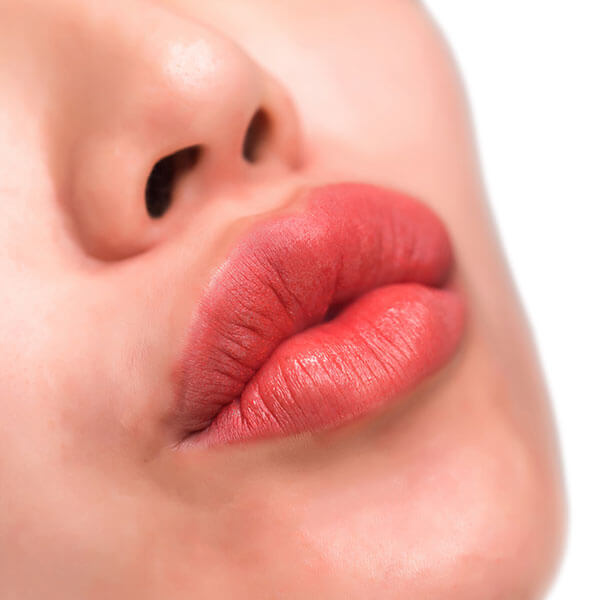 Lippenvergrößerung